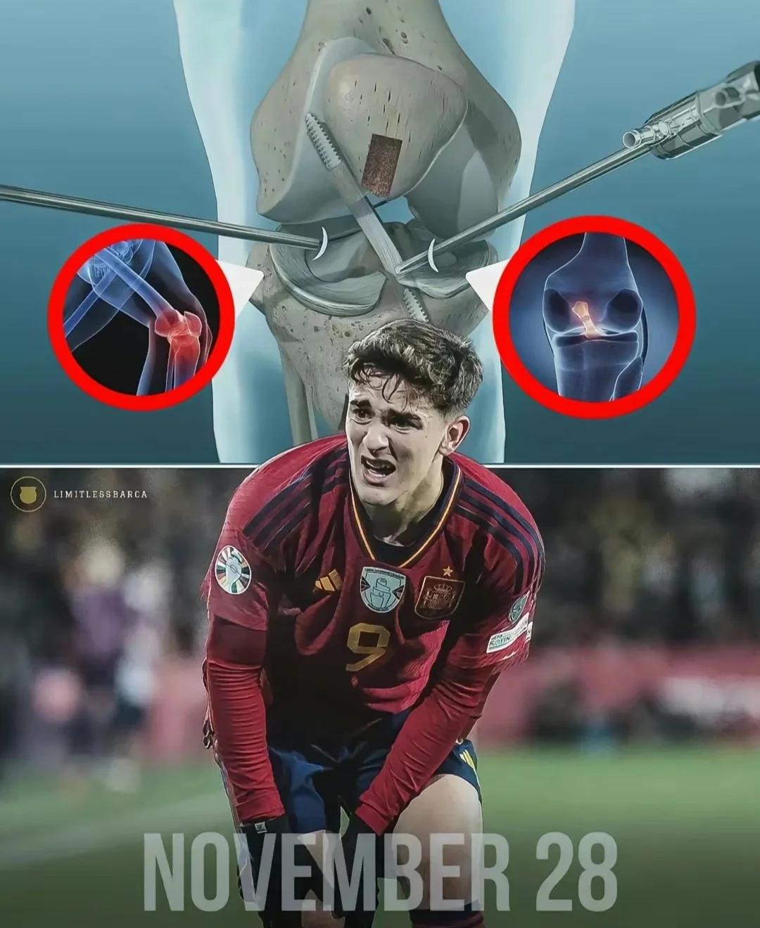 KOK体育-斯图加特球员紧急受伤,或将缺席比赛(斯图加特主力球员)